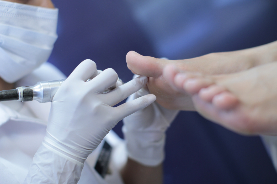 Clínica de Pie Diabético en Puebla